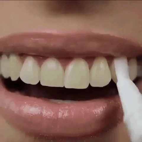 قلم تبييض الأسنان الفوري 2