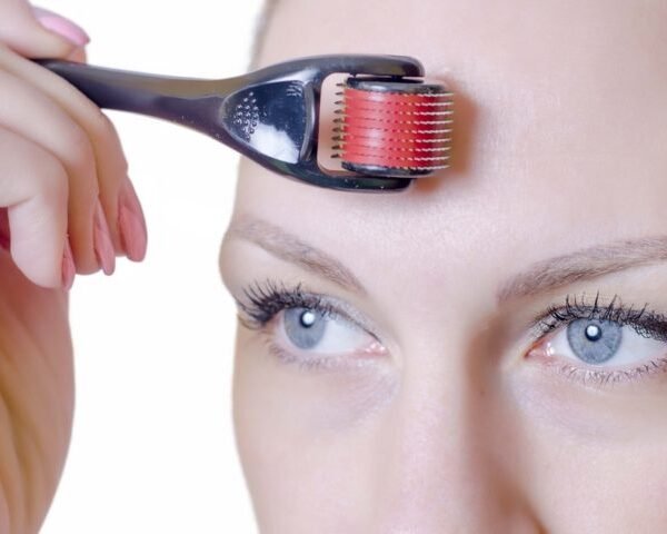 ديرما رولر Derma Roller For Skin Scaring (4)